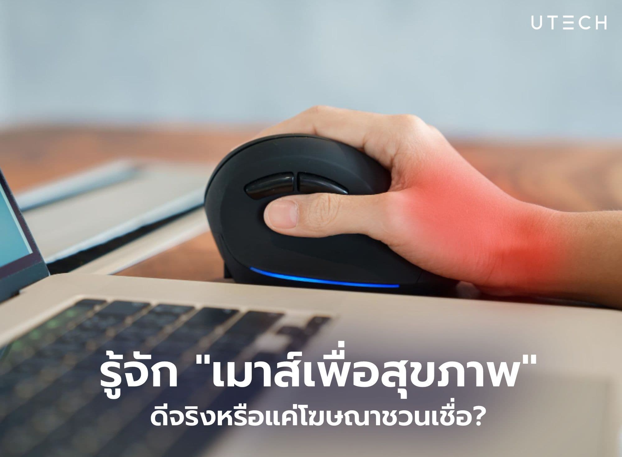 รู้จัก "เมาส์เพื่อสุขภาพ" (Ergonomic Mouse) ดีจริงหรือแค่ชวนเชื่อ?